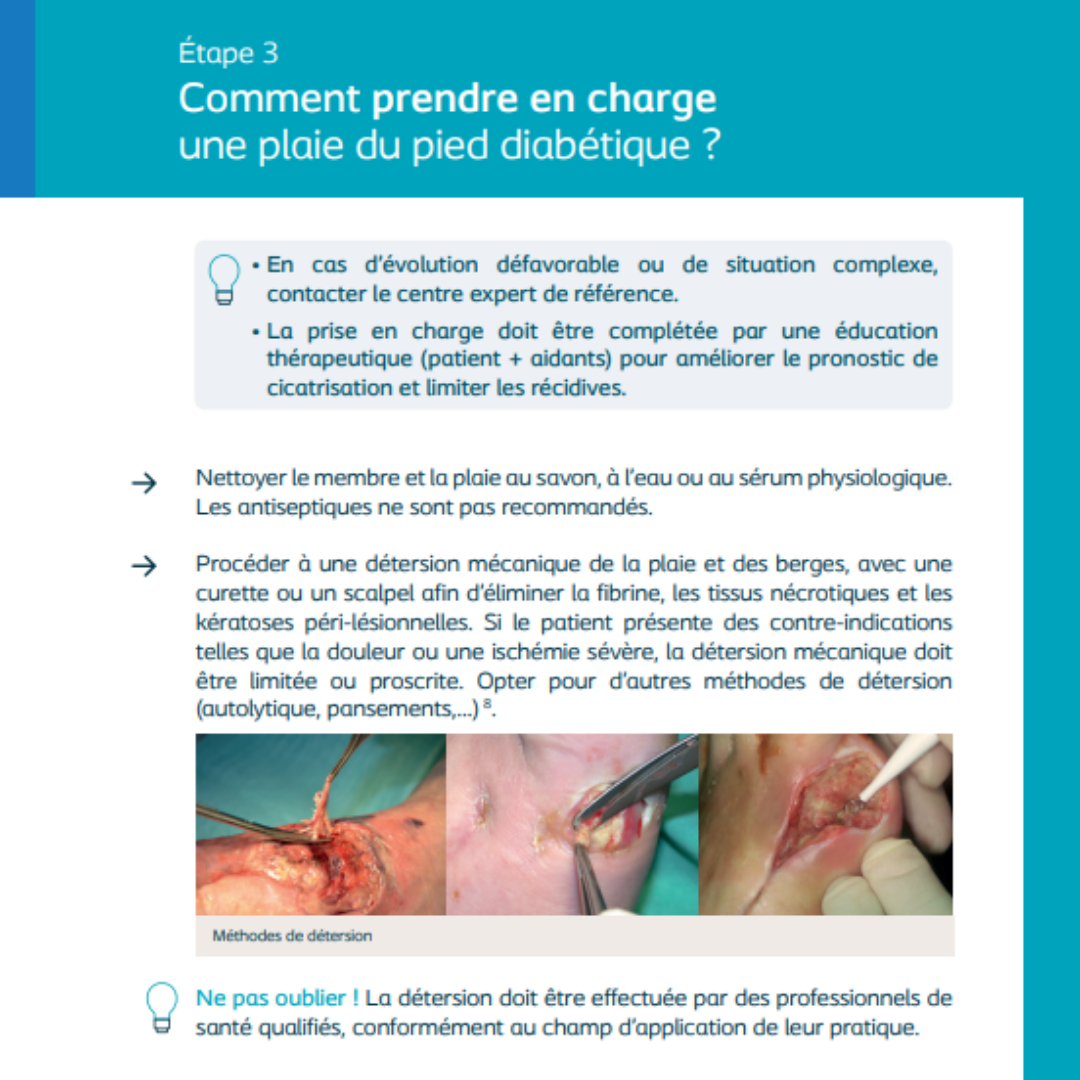 Comment prendre en charge?
